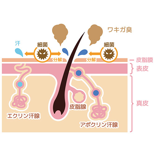 わきが